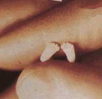 Precious Feet Picture